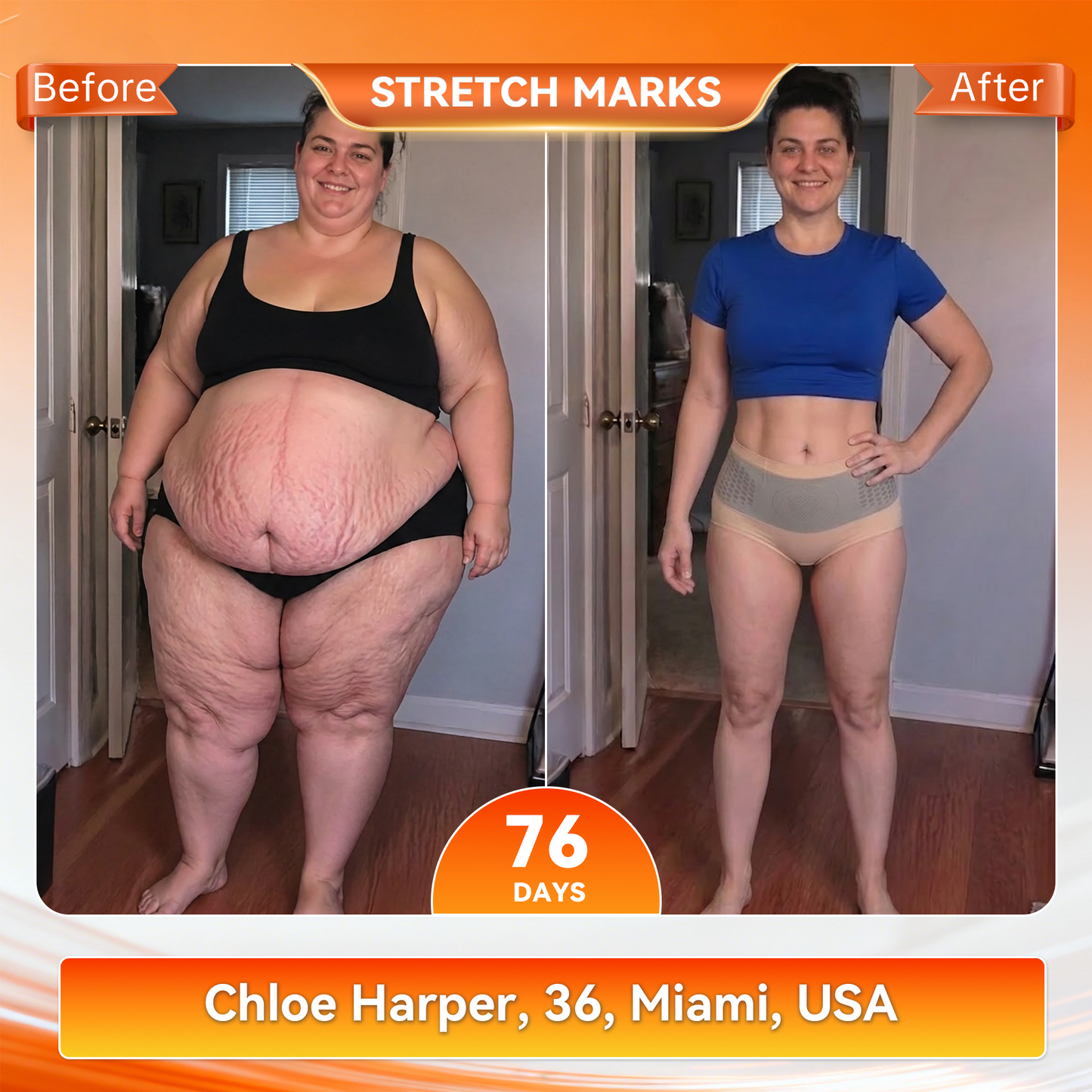 𝐎𝐟𝐟𝐢𝐜𝐢𝐚𝐥 𝐁𝐫𝐚𝐧𝐝 𝐒𝐭𝐨𝐫𝐞 🇺🇸| 𝐀𝐊𝐘𝐆𝐎® 𝟐𝟎𝟐𝟔 𝐌𝐨𝐫𝐢𝐧𝐠𝐚 x 𝐁𝐞𝐫𝐛𝐞𝐫𝐢𝐧𝐞 x 𝐍𝐀𝐃+ 𝟔-𝐈𝐧-𝟏 𝐌𝐢𝐜𝐫𝐨-𝐏𝐚𝐫𝐭𝐢𝐜𝐥𝐞 𝐒𝐜𝐮𝐥𝐩𝐭𝐢𝐧𝐠 & 𝐅𝐚𝐭-𝐁𝐮𝐫𝐧 𝐒𝐡𝐨𝐫𝐭𝐬 (Women + Men with Enhanced Male Vitality Blend💪)