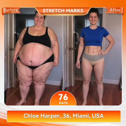 𝐎𝐟𝐟𝐢𝐜𝐢𝐚𝐥 𝐁𝐫𝐚𝐧𝐝 𝐒𝐭𝐨𝐫𝐞 🇺🇸| 𝐀𝐊𝐘𝐆𝐎® 𝟐𝟎𝟐𝟔 𝐌𝐨𝐫𝐢𝐧𝐠𝐚 x 𝐁𝐞𝐫𝐛𝐞𝐫𝐢𝐧𝐞 x 𝐍𝐀𝐃+ 𝟔-𝐈𝐧-𝟏 𝐌𝐢𝐜𝐫𝐨-𝐏𝐚𝐫𝐭𝐢𝐜𝐥𝐞 𝐒𝐜𝐮𝐥𝐩𝐭𝐢𝐧𝐠 & 𝐅𝐚𝐭-𝐁𝐮𝐫𝐧 𝐒𝐡𝐨𝐫𝐭𝐬 (Women + Men with Enhanced Male Vitality Blend💪)